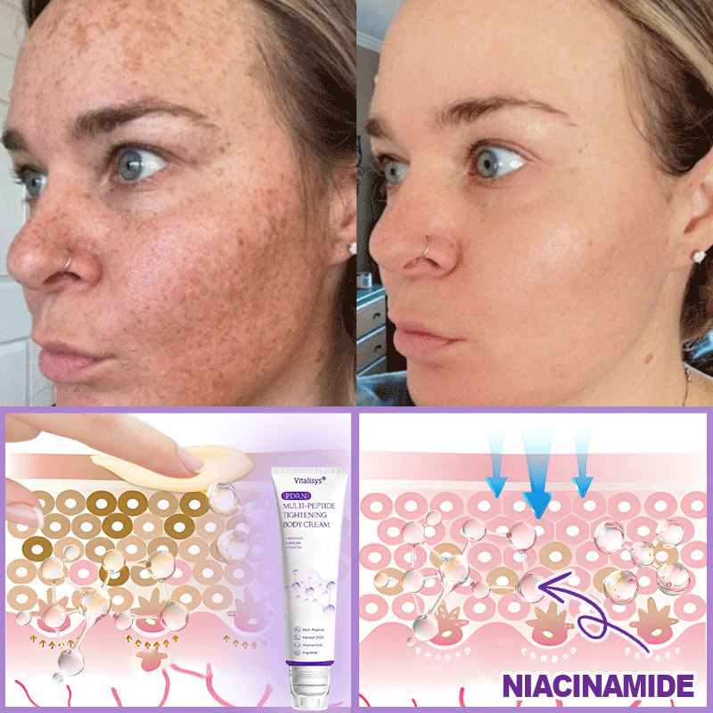 𝐏𝐡𝐚𝐫𝐦𝐚𝐜𝐢𝐬𝐭 𝐫𝐞𝐜𝐨𝐦𝐦𝐞𝐧𝐝𝐞𝐝✨ 𝐕𝐢𝐭𝐚𝗹𝒊𝒔𝒚𝒔® 💕 𝗣𝗗𝗥𝐍 𝐌𝐮𝗹𝘁𝗶-𝗣𝗲𝗽𝘁𝗶𝗱𝐞 𝐌𝐚𝐬𝐬𝐚𝐠𝐢𝐧𝐠 𝐁𝐨𝐝𝐲 𝐑𝐨𝐥𝐥𝐞𝐫 𝐂𝐫𝐞𝐚𝐦- Anti-aging, Hydrating, Skin Firming & Lifting, Skin Repair, Even Tone, Acne and Dark Spot Treatment, Wart and Mole Removal, and Psoriasis Relief.